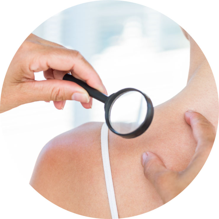 Medimos la eficacia en voluntarios